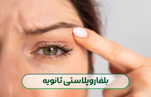 بلفاروپلاستی ثانویه