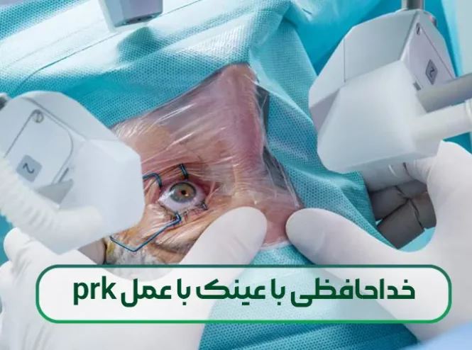 خداحافظی با عینک با عمل prk