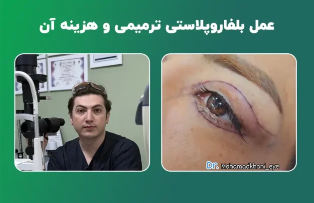 بلفاروپلاستی ترمیمی