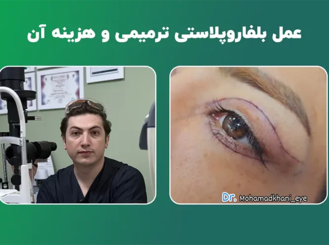 بلفاروپلاستی ترمیمی