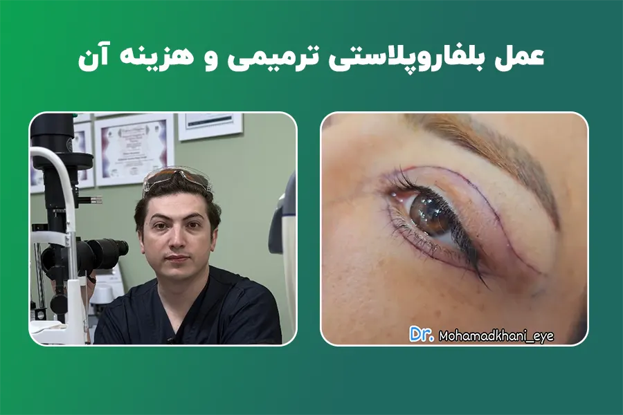 بلفاروپلاستی ترمیمی