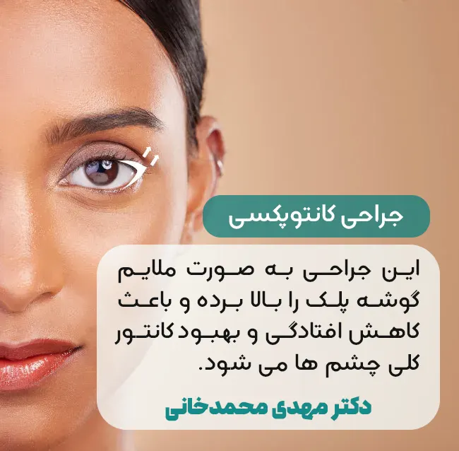 جراحی کانتوپکسی