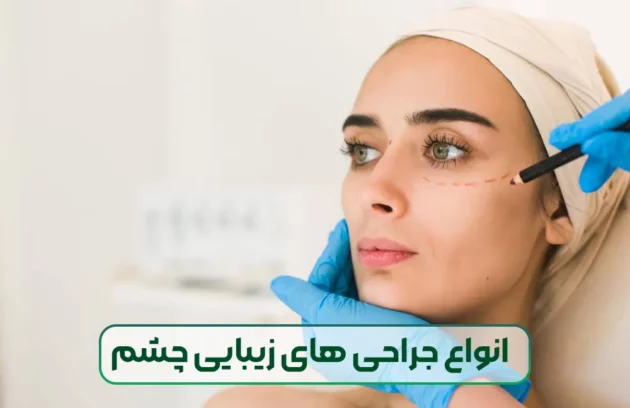 انواع جراحی های زیبایی چشم