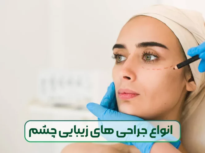 انواع جراحی های زیبایی چشم