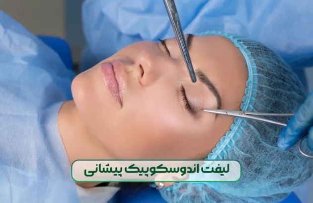 لیفت اندوسکوپیک پیشانی