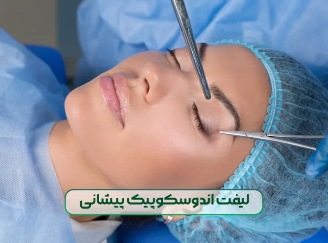 لیفت اندوسکوپیک پیشانی