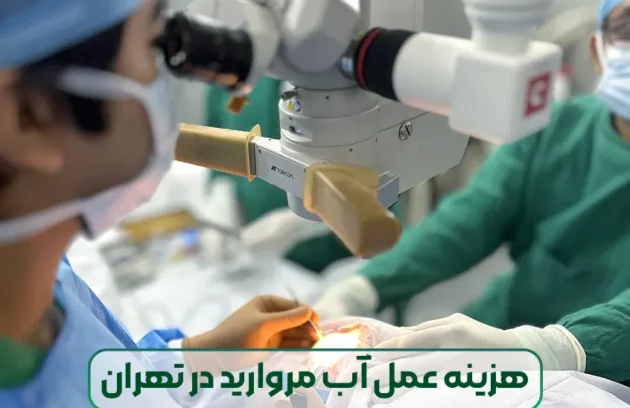 هزینه عمل آب مروارید