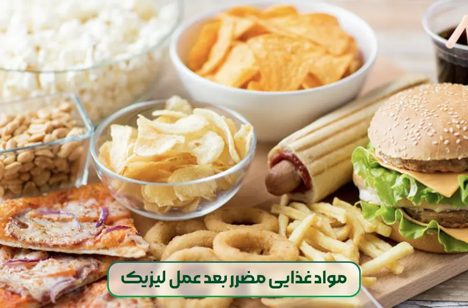 مواد غذایی مضرر بعد عمل لیزیک