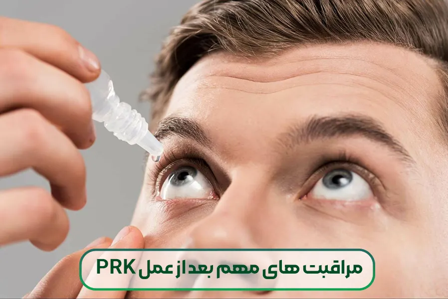 مراقبت های اولیه پس از عمل PRK