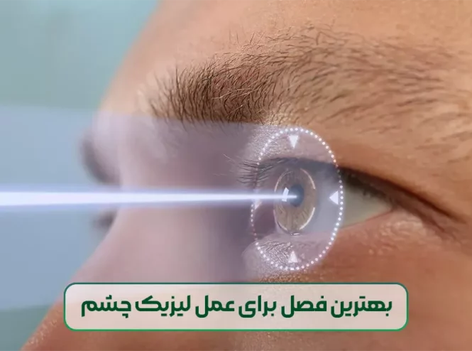بهترین فصل برای عمل لیزیک چشم