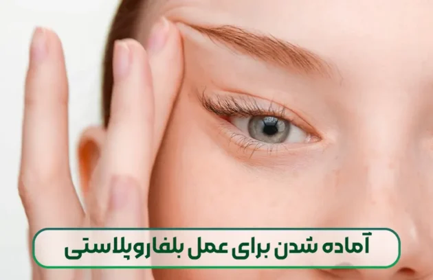 آماده شدن برای عمل بلفاروپلاستی