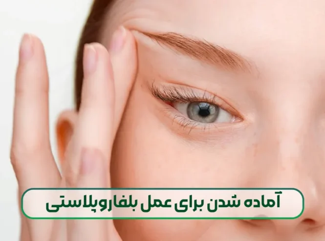 آماده شدن برای عمل بلفاروپلاستی