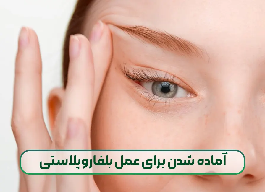 آماده شدن برای عمل بلفاروپلاستی