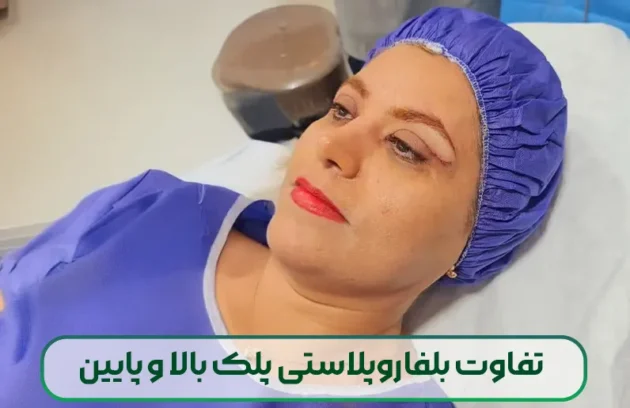 تفاوت بلفاروپلاستی پلک بالا و پایین