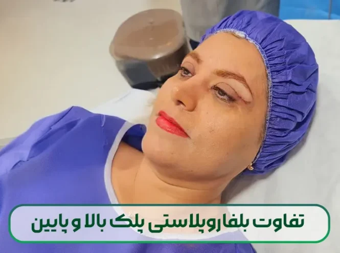 تفاوت بلفاروپلاستی پلک بالا و پایین