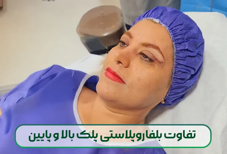 تفاوت بلفاروپلاستی پلک بالا و پایین