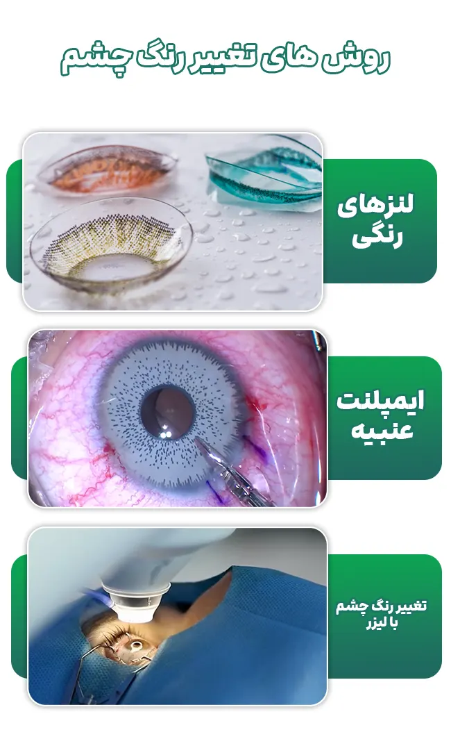 روش های تغییر رنگ چشم