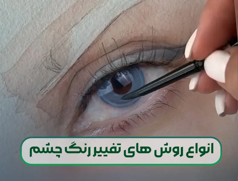 تغییر رنگ چشم