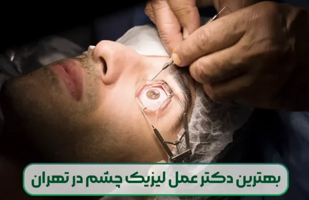 بهترین دکتر عمل لیزیک چشم در تهران