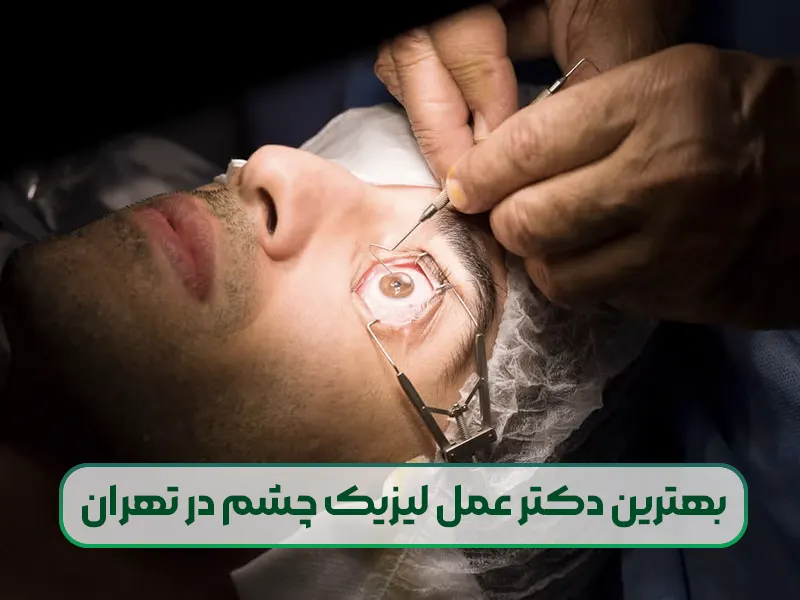 بهترین دکتر عمل لیزیک چشم در تهران