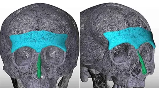 پیشانی نئاندرتالی