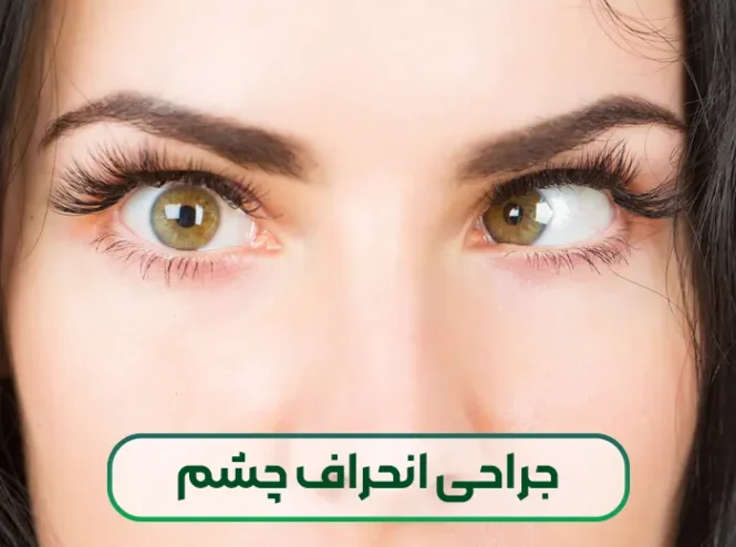 جراحی انحراف چشم