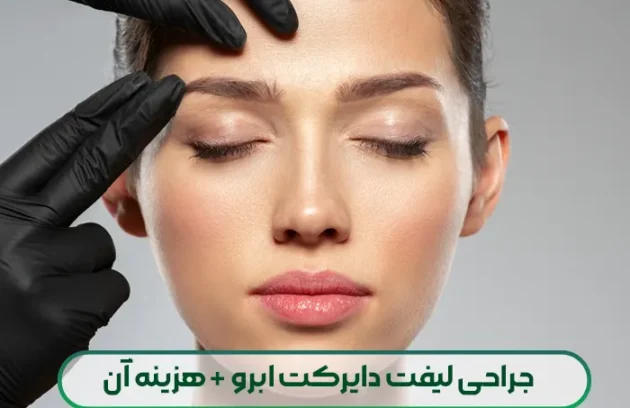 جراحی لیفت دایرکت ابرو