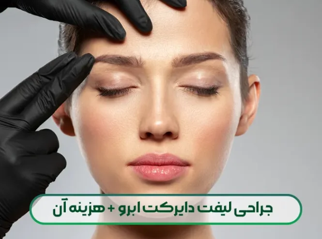 جراحی لیفت دایرکت ابرو
