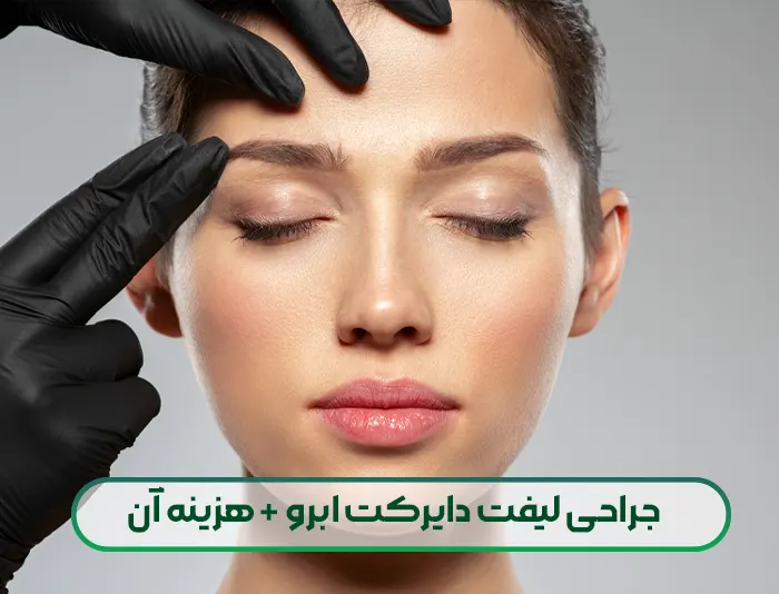 جراحی لیفت دایرکت ابرو