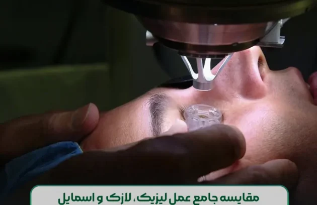 مقایسه جامع عمل لیزیک و لازک (prk) و اسمایل