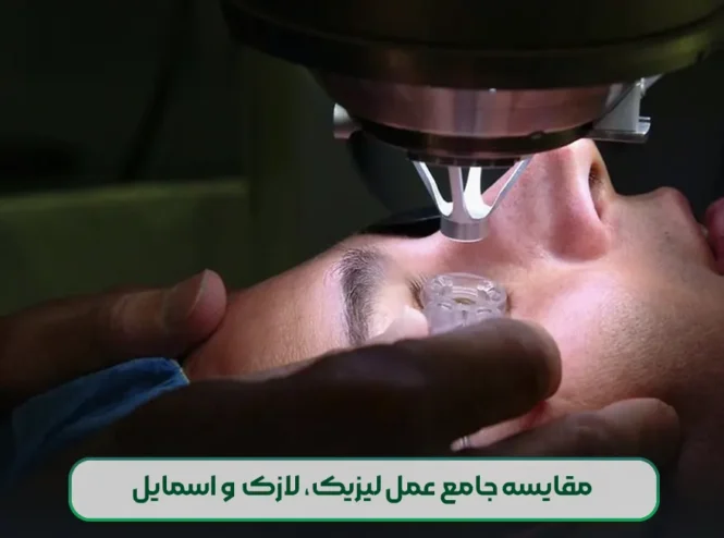 مقایسه جامع عمل لیزیک و لازک (prk) و اسمایل