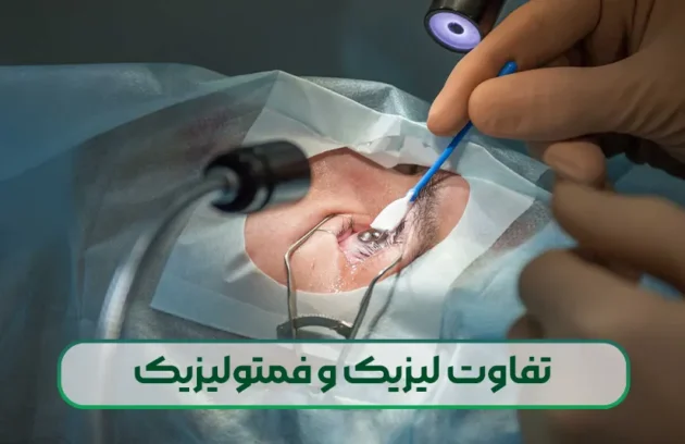 تفاوت لیزیک و فمتولیزیک