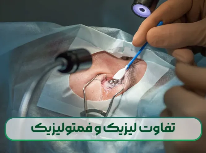 تفاوت لیزیک و فمتولیزیک