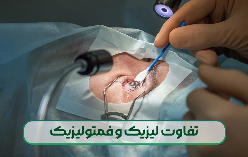 تفاوت لیزیک و فمتولیزیک