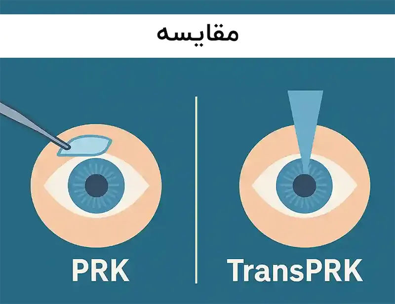 تفاوت پی آر کی و ترنس پی آر کی