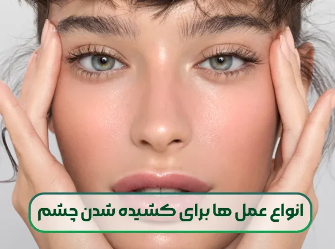 انواع عمل ها برای کشیده شدن چشم