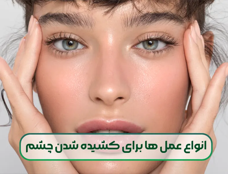 انواع عمل ها برای کشیده شدن چشم