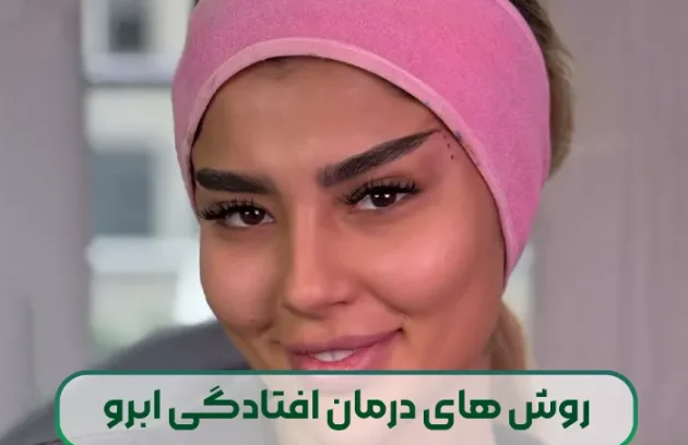 روش های درمان افتادگی ابرو