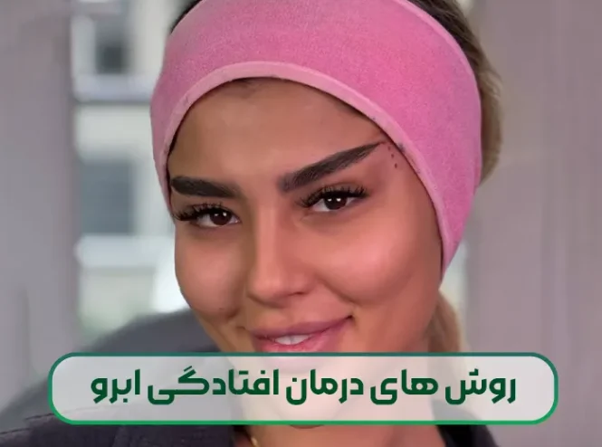 روش های درمان افتادگی ابرو