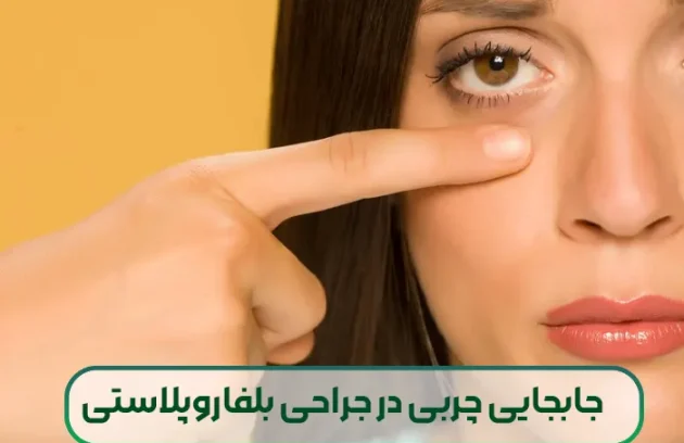 جابجایی چربی در جراحی بلفاروپلاستی پلک پایین