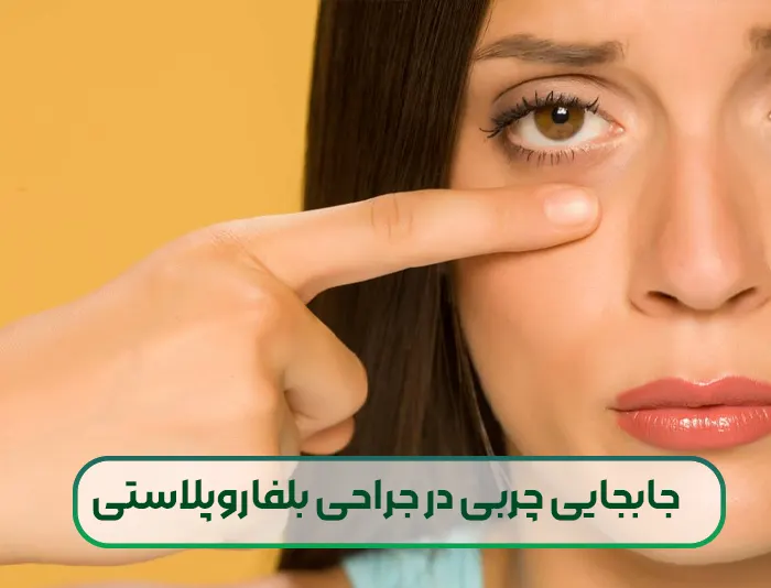 جابجایی چربی در جراحی بلفاروپلاستی پلک پایین