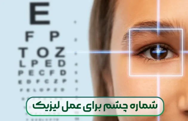 شماره چشم برای عمل لیزیک
