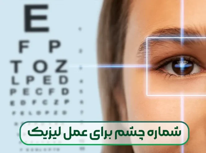 شماره چشم برای عمل لیزیک