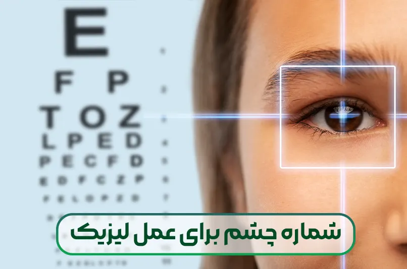 شماره چشم برای عمل لیزیک