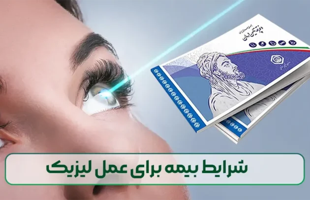 شرایط بیمه برای عمل لیزیک