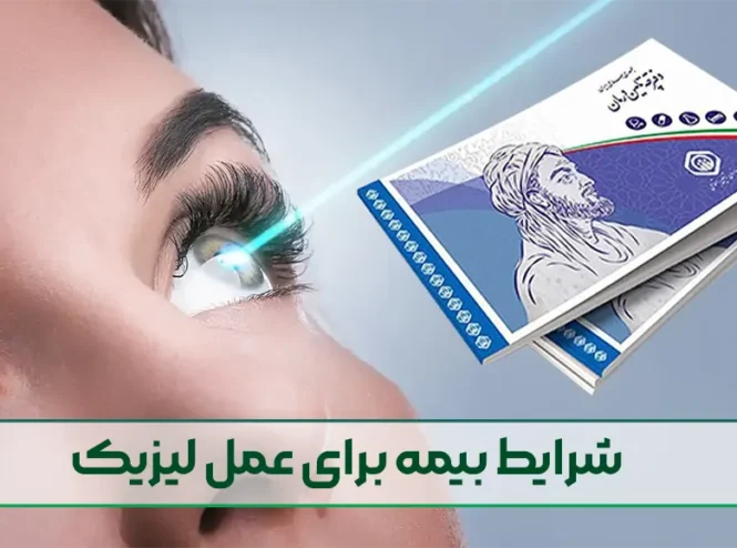 شرایط بیمه برای عمل لیزیک