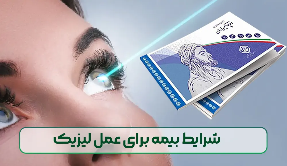 شرایط بیمه برای عمل لیزیک