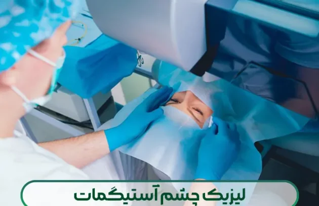لیزیک چشم آستیگمات
