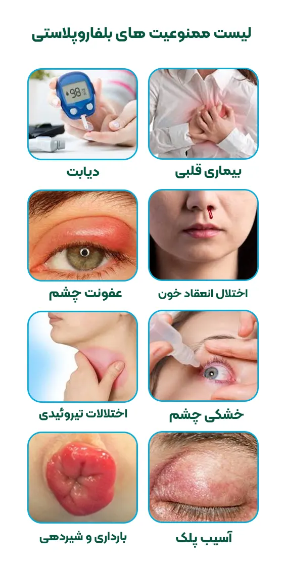 لیست کامل ممنوعیت های بلفاروپلاستی