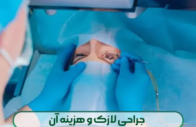 جراحی لازک و هزینه آن
